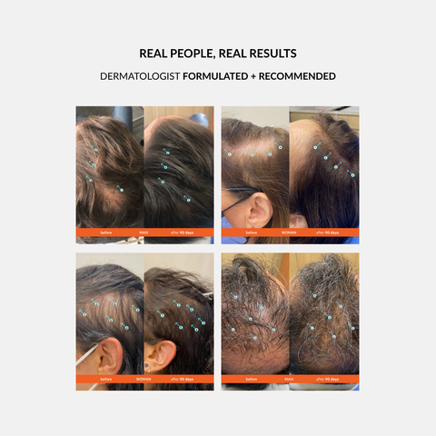 DS Laboratories Women’s Hair Density Kit